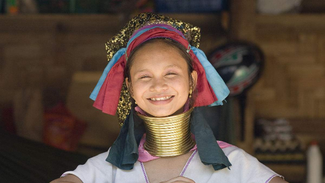 长颈族的女人取下铜项圈是什么样的?看完后都替她们心疼